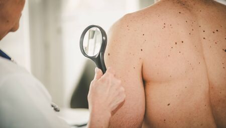 Dermatologist examining the skin on the arm of a patientの写真素材