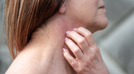 Woman having itchy and scratching her neckの写真素材