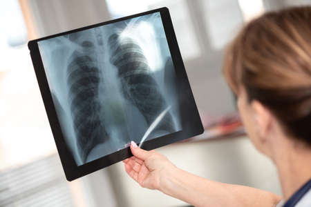 Female doctor examining x-ray report in medical office