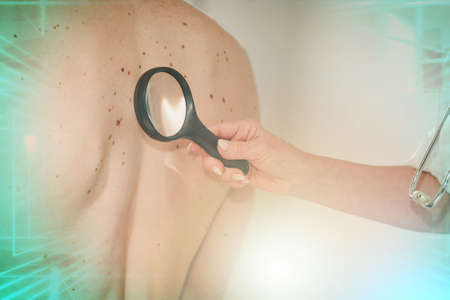 Dermatologist examining the skin on the back of a patient; multiple exposure