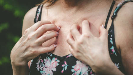 Woman having itchy and scratching her chestの写真素材
