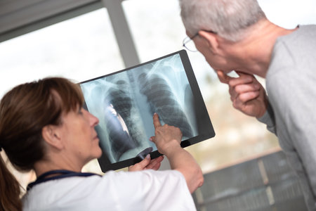 Female doctor showing xray to her patient in medical officeの写真素材