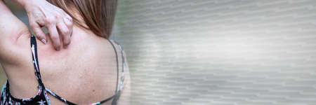 Woman having itchy and scratching her back; panoramic bannerの写真素材