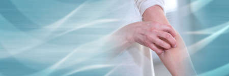 Woman having itchy and scratching her arm. allergy symptoms; panoramic banner