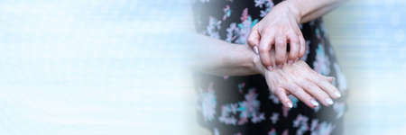 Woman having itchy and scratching her hand; panoramic bannerの写真素材