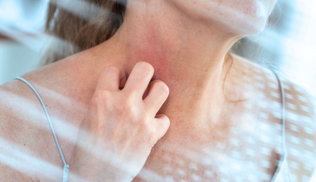 Woman having itchy and scratching her neck. allergy symptoms; light-effectの写真素材