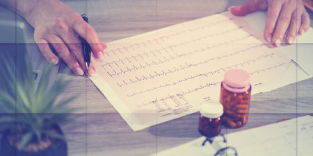 Female cardiologist examining an ecg graph in medical office, geometric patternの写真素材