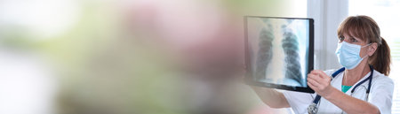 Female doctor wearing a medical face mask and examining lungs x-ray during coronavirus outbreak; panoramic bannerの写真素材