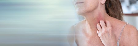 Woman having itchy and scratching her neck. allergy symptoms; panoramic banner