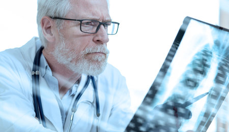 Doctor looking at x-ray report; light effect
