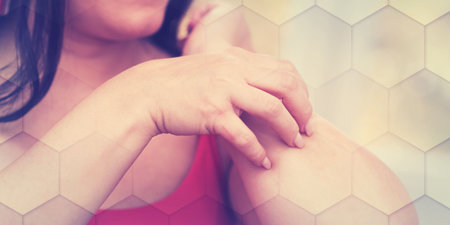 Young woman having itchy and scratching her arm, geometric pattern