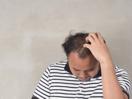 Man Scratching Head.の写真素材