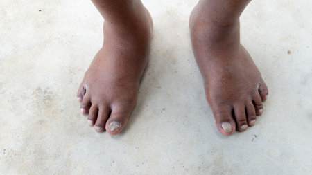 Above view of swollen feet on both sides. health problems of the elderly. stand barefoot on the concrete floor.の写真素材