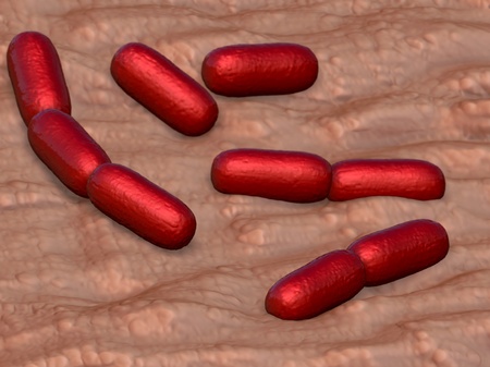 bacterial infection