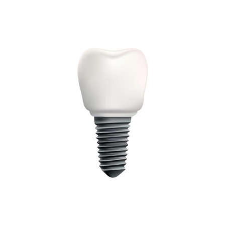 Dental implant on white background vector illustrationのイラスト素材
