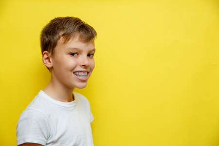 Boy wearing night-guard case . Close-up of orthodontic silicone trainer. Orthodontics problemの写真素材
