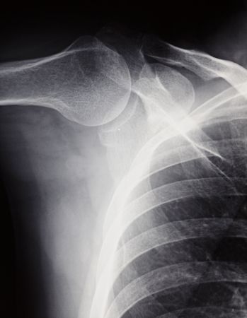 xray imageの写真素材