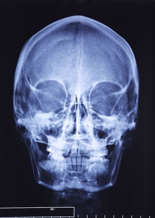 closeup image of classic xray image of skullの写真素材