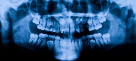 fine image of xray face