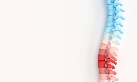 3d illustration render of a spine with highlighted aching parts. Back care concept.の写真素材