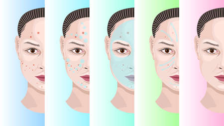 Woman face step by step treatment acneのイラスト素材