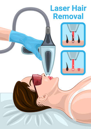 Laser Hair Removal Face Woman isolated Cartoonのイラスト素材