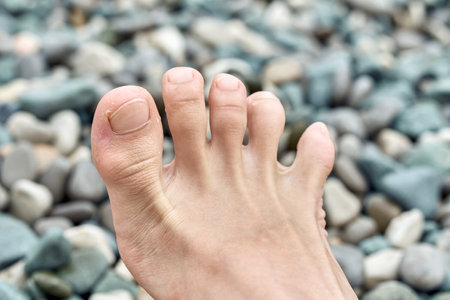 Tourist bare foot fingers against blurry pebble beach near sea. Person moves toes wanting to explore...