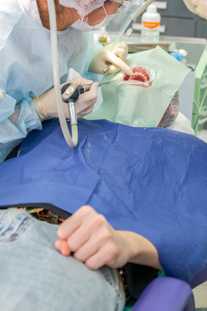 Patient anxiously clenches their fist in fear while receiving dental treatment at a clinic while dental team is focused on the task at handの写真素材