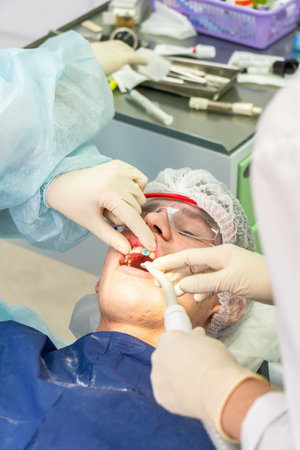 Dental professional performs cleaning procedure on a patient to remove plaque, ensuring dental health and teeth whitenessの写真素材