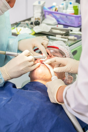 Dental professional performs cleaning procedure on a patient to remove plaque, ensuring dental health and teeth whitenessの写真素材