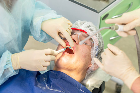 Dental professional performs cleaning procedure on a patient to remove plaque, ensuring dental health and teeth whitenessの写真素材