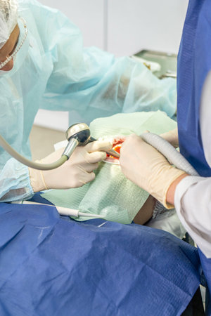 Two dental professionals perform a procedure on a patient in a clinical environment, focused and attentive to detailsの写真素材