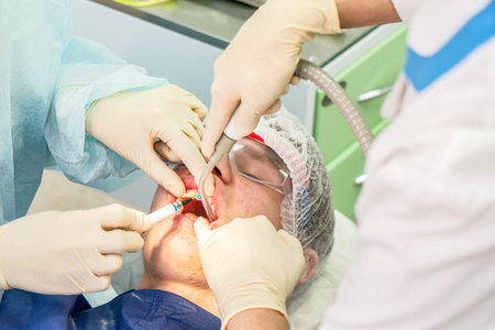 Dental professional performs cleaning procedure on a patient to remove plaque, ensuring dental health and teeth whitenessの写真素材