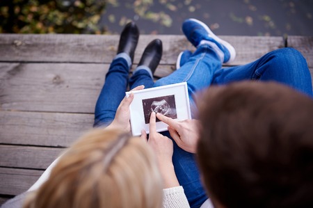 Happy couple are holding ultrasound scan of their baby.