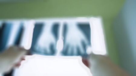 Blurry view of doctor examine X ray of Hand. Hand holding the xray picture, while the Doctor are looking for Fracture on the patients pictureの写真素材