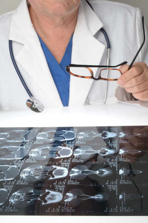 Doctor and CT scan