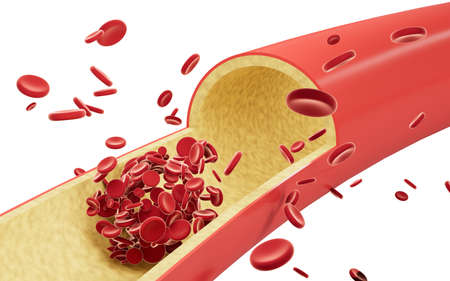 Red blood cells flowing through blood vessels, 3d rendering. Computer digital drawing.の写真素材