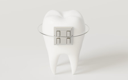 Tooth brace in the white background, 3d rendering. Computer digital drawing.の写真素材