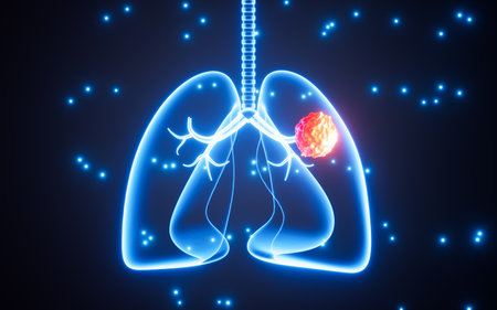 Human lung tumor, human lung cancer, 3d rendering. Digital drawing.の写真素材
