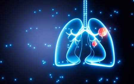 Human lung tumor, human lung cancer, 3d rendering. Digital drawing.の写真素材