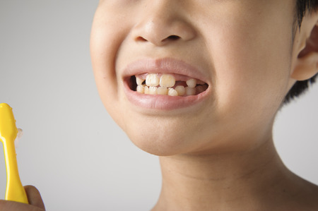 The boy open his mounth to show the clean teeth.の写真素材