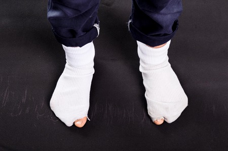 White old sock damage and hole in kind feetの写真素材