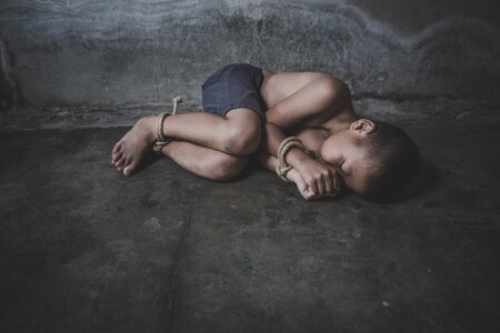 Child who are victims of the human trafficking process and have bruises on their faces. Child labor, Concept of ending violence against children and human rights.の写真素材