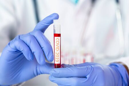 Doctor holding test tube with blood for 2019-nCoV analyzing. covid-19 virus, Coronavirus blood test...