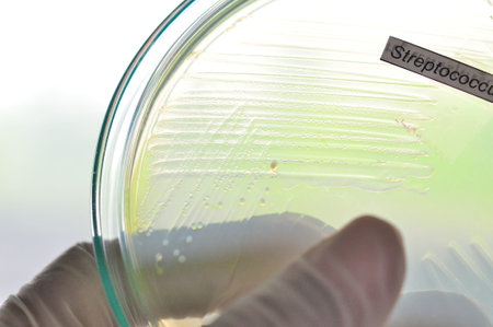yellow colony in petridish