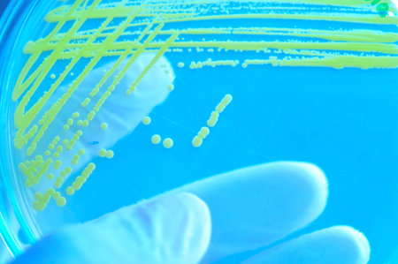 yellow colony in petridish