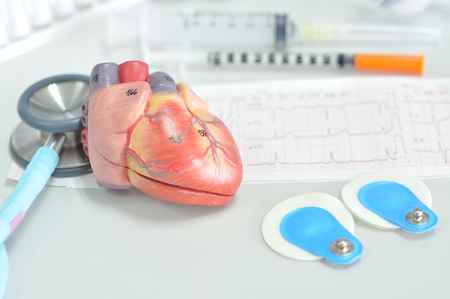 diagnosis of human heartの写真素材