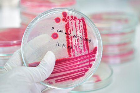 red colony in petridish in microbiology laboratory test