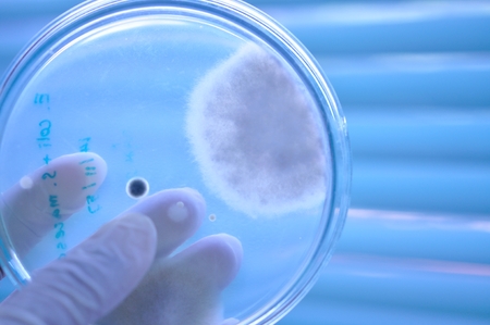 fungi in petridishの写真素材