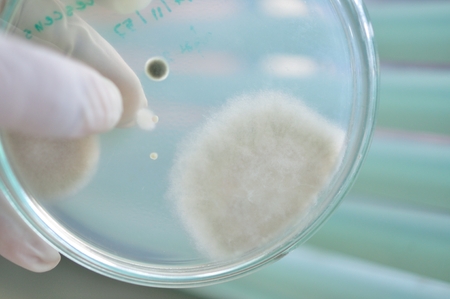 fungi in petridishの写真素材